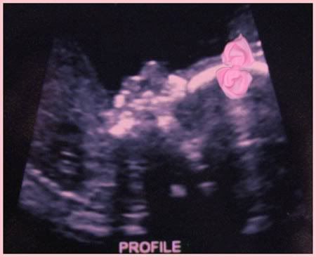 baby,ultrasound,girl
